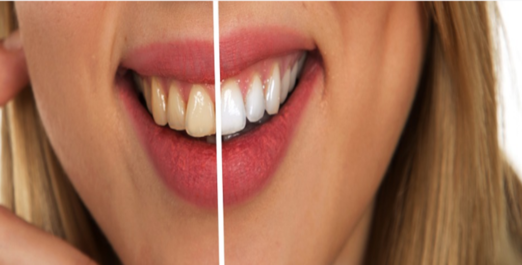 clean teeth