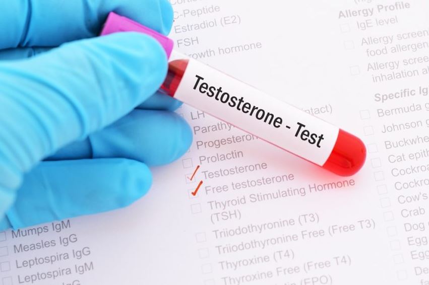 testosterone test